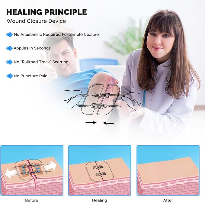 Zip Stitch Emergency Wound Closure Strips - 2Pcs Laceration Closure Kit Closures Repair Wounds Without Stitches - Butterfly Bandaids Bandages for Wounds